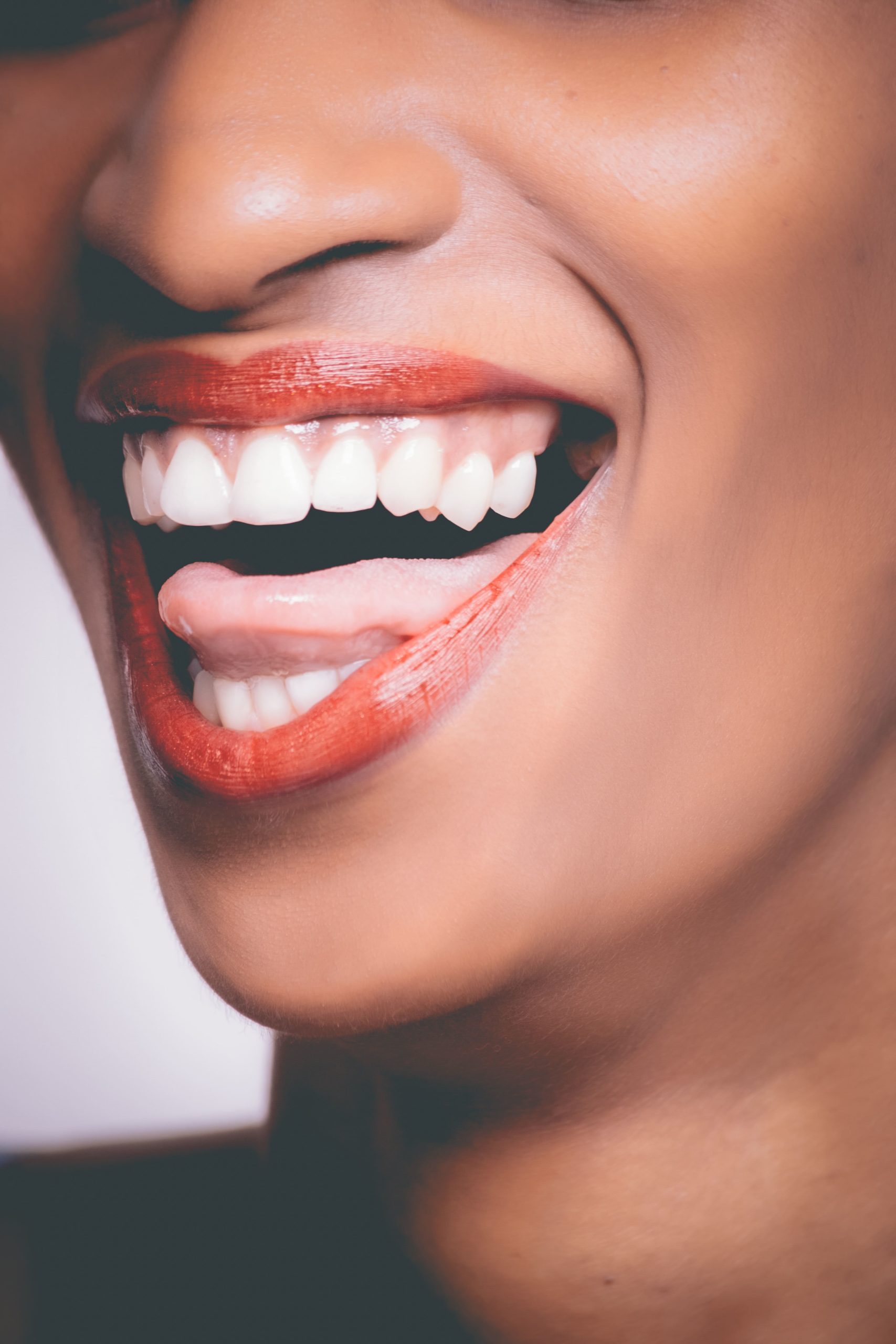 un sorriso con denti da star