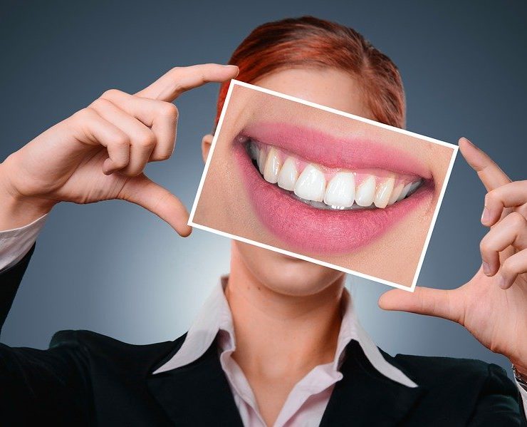 un sorriso con denti da star