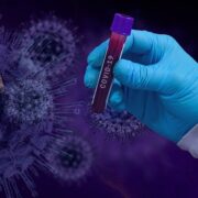 anticorpo da guarito da Sars efficace per coronavirus